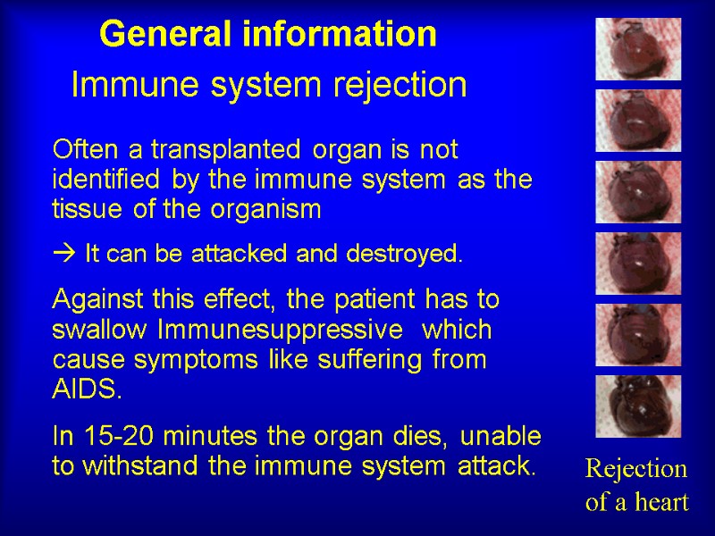 Immune system rejection  Often a transplanted organ is not identified by the immune